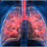 Air Pollution: To save lungs from pollution, include these 7 foods in the diet